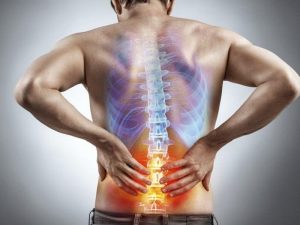 tratamiento ciática con fisioterapia